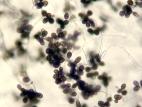 Ulocladium_sp_4