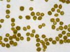 Urocystis_magica_1