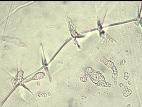 Verticillium_fungicola_1