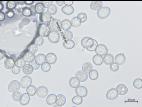 Albugo candida_2