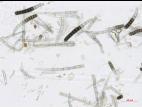 Chlamydospores et conidies de Berkeleyomyces basicola (syn. Thielaviopsis basicola)