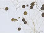 Epicoccum sp.