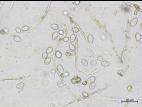 Phytophthora infestans - sporange