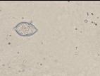 Phytophthora infestans - sporange
