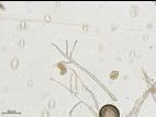 Phytophthora infestans - sporange