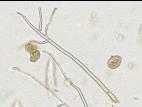 Phytophthora infestans - sporange