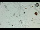 Phytophthora infestans