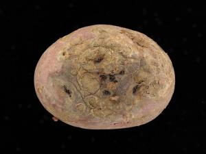 Pomme de terre - Gale poudreuse (Spongospora subterranea)
