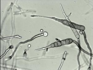 Conidie d'Alternaria solani