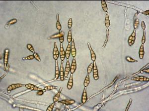 Alternaria_alternata-02_LQ