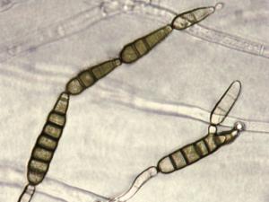 Alternaria_brassicicola-05_LQ