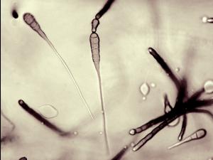 Alternaria_cichorii-07_LQ