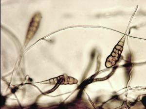 alternaria_dauci-11-ret.jpg