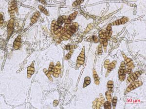Alternaria_japonica_D34952-1_LQ
