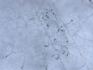 Colletotrichum_Appressoria_D50604-1