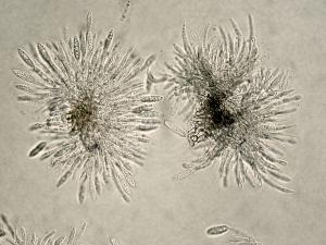 Colletotrichum_acutatum-01