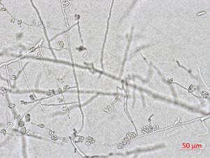 Colletotrichum_coccodes_D35079-1_LQ