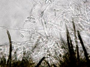 Colletotrichum_malvarum-02