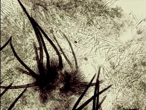 Colletotrichum_truncatum-10