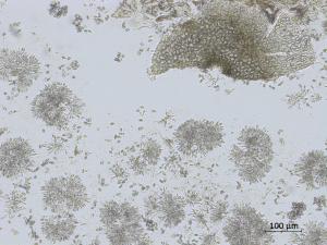 Coniella_diplodiella_D33070-2