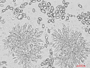 Coniella_diplodiella_D33070-3_LQ