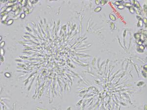 Coniella_diplodiella_D33070-4