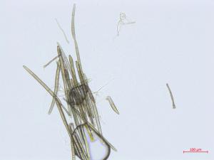 Corynespora_cassiicola_D55060-1_Conidie_LQ