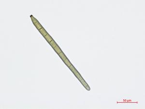 Corynespora_cassiicola_D55060-2_Conidie_LQ