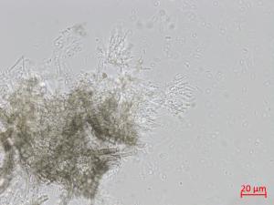 Cytospora_D47367-1_LQ