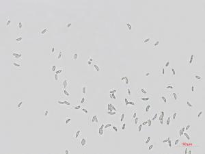 Dictyochaeta_D34357-1_LQ