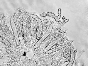 Didymella_applanata-01_LQ