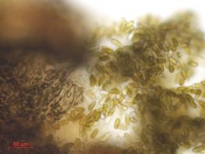 Diplodia_seriata_D45264-2_LQ