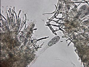 didymascella thujina-03-ret