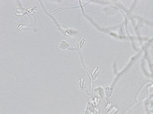 Fusarium_proliferatum_4