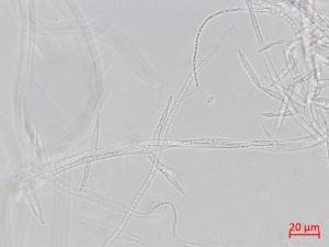 Fusarium_proliferatum_3