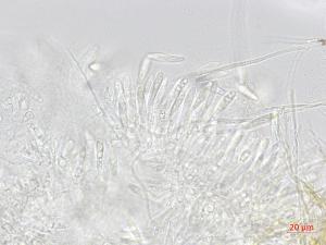 Fusicoccum_aesculi_1