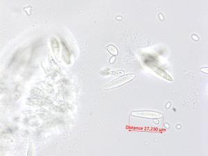 Fusicoccum_aesculi_2