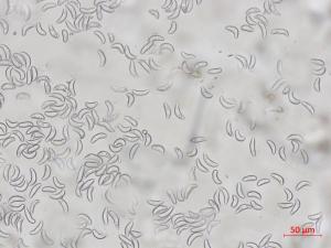 Gloeosporidiella_ribis_2