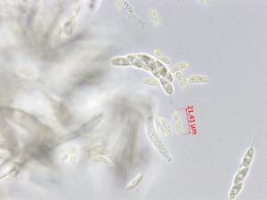 Glomerella_sp_1