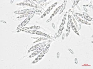 Glomerella_miyabeana_1