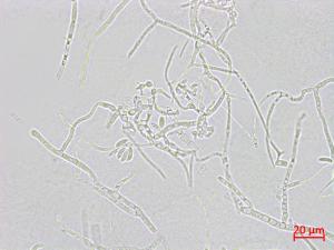Microdochium_sp_2