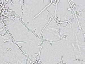 Microdochium_sp_3