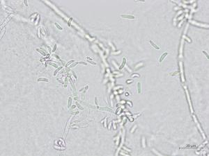 Microdochium_sp_4
