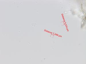 Phyllosticta_ampelicida_4