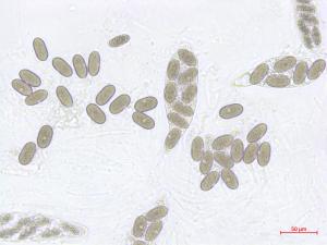 Physalospora_vaccinii_2