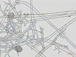 Pseudoperonospora_sp_1