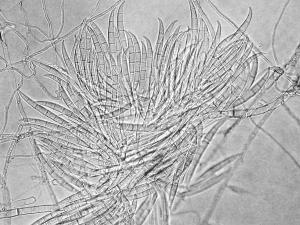 Fusarium_graminearum_1