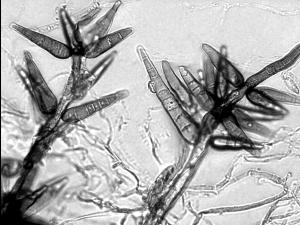 Helminthosporium_sp_1