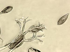 Peronospora_destructor_3