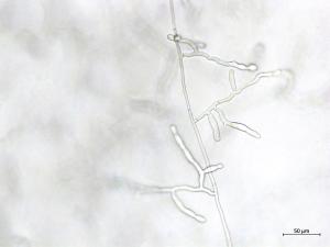 Rhizoctonia_sp_3